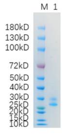 SDS-PAGE (PRNP-1198H).jpg